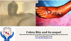 Snakebite Health Literacy